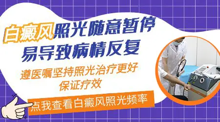 白斑照光能停照吗