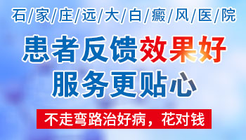 「石家庄白癜风医院」哪家好 石家庄远大白癜风医院