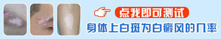 眉毛上突然出现一块白斑