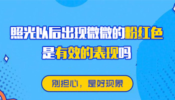 嘴的左边长白癜风照激光发粉红色是好转吗