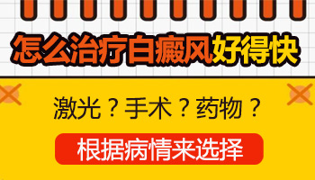 新生儿有白癜风能擦药吗