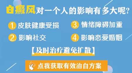 90后必看：白癜风的危害曝光