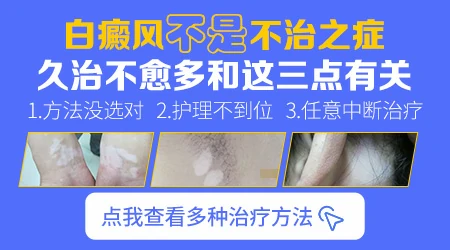 宝宝白癜风照308有副作用吗