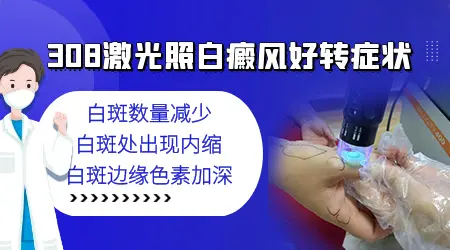 白癜风照308激光治疗要几个月