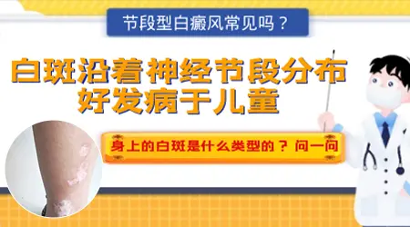 神经节段性白斑容易扩散吗