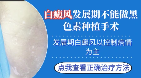 手脚白癜风可以做黑色素细胞手术吗
