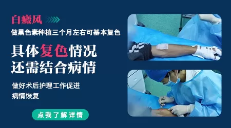 黑色素种植治白癜风效果好不好