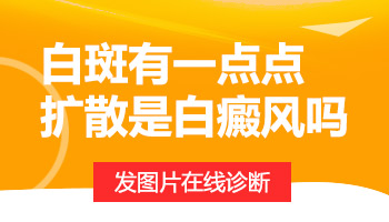 皮肤白斑就是白癜风吗 白癜风和其它白斑病有哪些区别