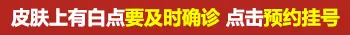 伍德灯检查白斑颜色对照表