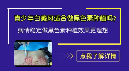 小孩白癜风做移植手术行不