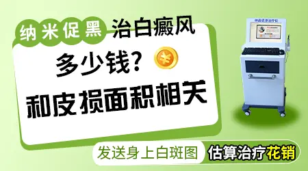 纳米促黑治疗白斑一次多少钱