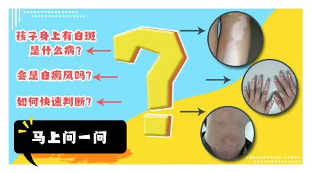 小孩腹部出现一片白色是什么