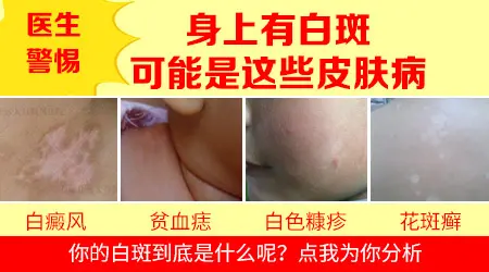 耳朵后边有白斑图片