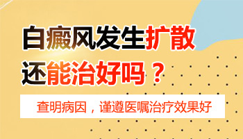 白癜风一直出新的白斑该怎么控制好