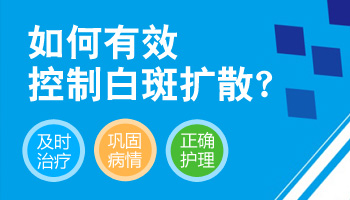 什么方法能控制脸上的白癜风不长