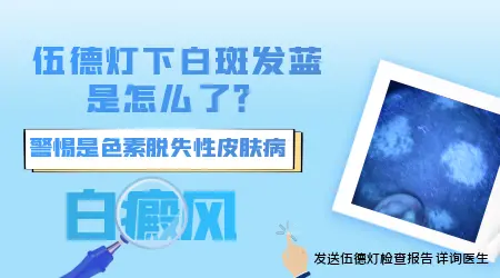 婴幼儿白斑需要做哪些检查