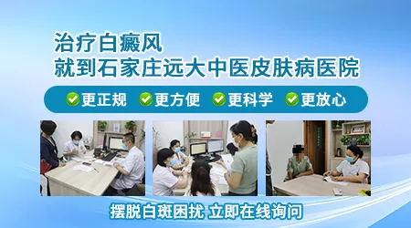 石家庄有能治好白癜风的医院吗