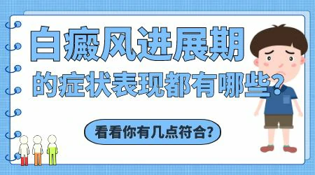 白癜风变白的过程会变大吗