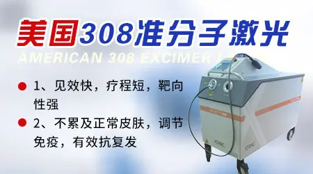 网上买的308激光仪有用吗