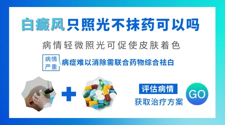 白癜风不用药用308灯会照黑吗