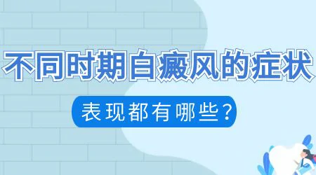 白癜风的症状有哪些