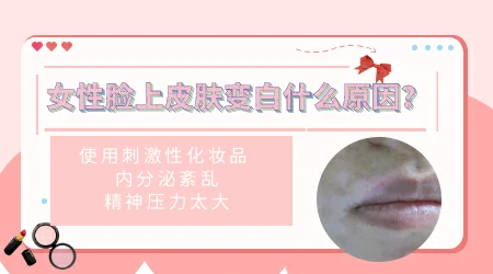 女性皮肤白斑的原因  为什么阳后皮肤发白