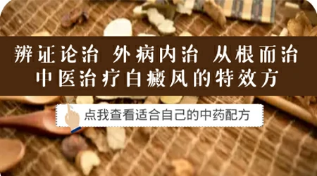 全身白癜风大面积照UvB有用吗