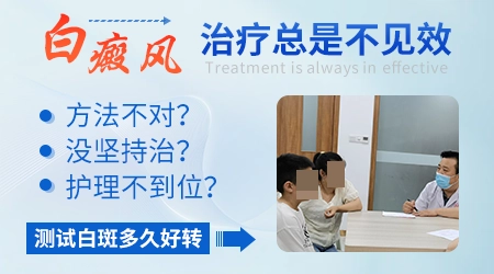 幼儿白癜风早期症状