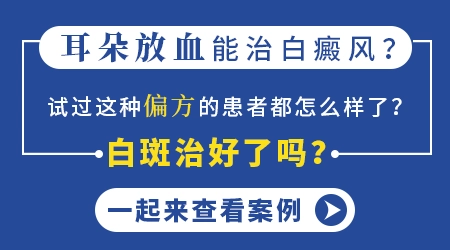 耳朵放血疗法对治疗白癜风管用吗