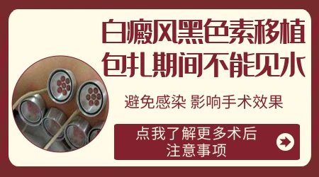 黑色素细胞种植治白斑多少钱