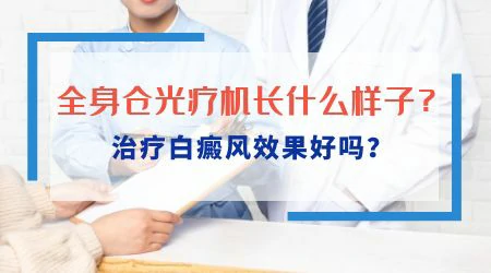 全身仓治疗白癜风效果怎么样