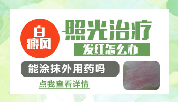 男性后背白癜风做完激光发红正常吗