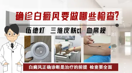 身上有白斑做个检查大概花多少钱