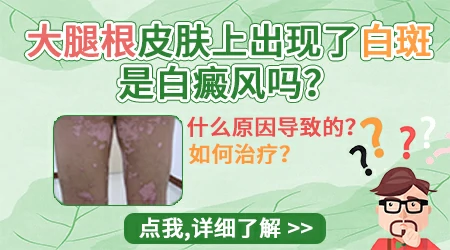 孩子大腿内侧有白色点点