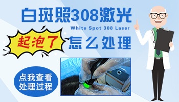 白斑做了308激光后起水泡了要怎么处理