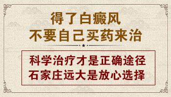 白斑疑似白癜风可以涂抹卤米松吗