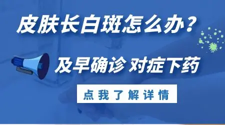 绿豆大小的白点是不是白癜风