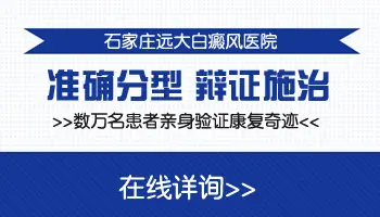 孩子遗传的白癜风怎么治疗有效