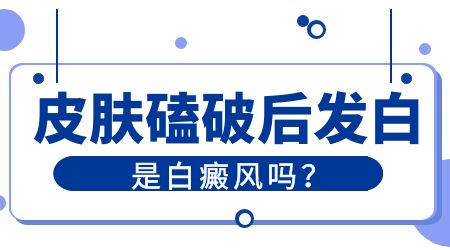 手臂有块皮肤发白是白癜风吗 如何诊断白癜风