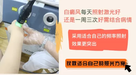 308激光多久照一次比较好