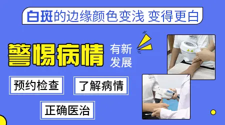 白癜风颜色变浅变大