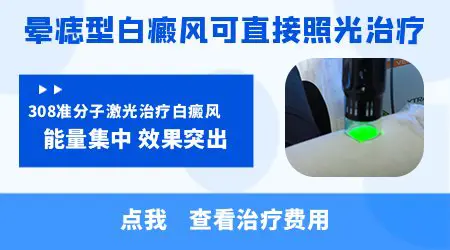 晕痣型白斑的治疗方法
