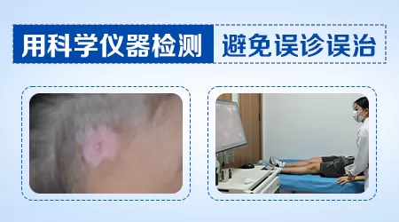 皮肤变白是什么皮肤病