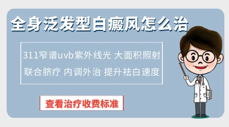 全身都有白癜风用什么方法治