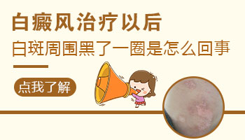 <a href=https://www.zhjianfa.com/zhiliao/ target=_blank class=infotextkey>白癜风治疗</a>后比正常肤色黑