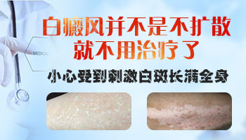 头部白癜风是什么样子的