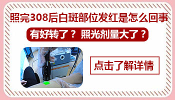 白癜风做激光后皮肤红红的还可以做激光吗