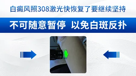 石家庄哪些医院有美国308光疗仪