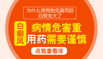 男性身上长白癜风的危害有哪些