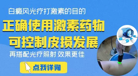 白癜风要吃多久激素药